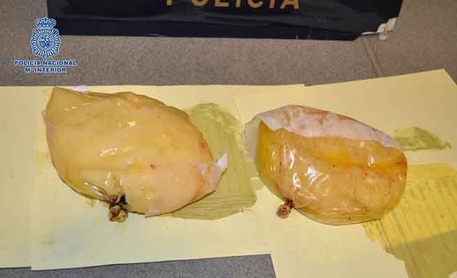 Arrêtée avec 1,4 kg de cocaïne caché dans ses implants mammaires