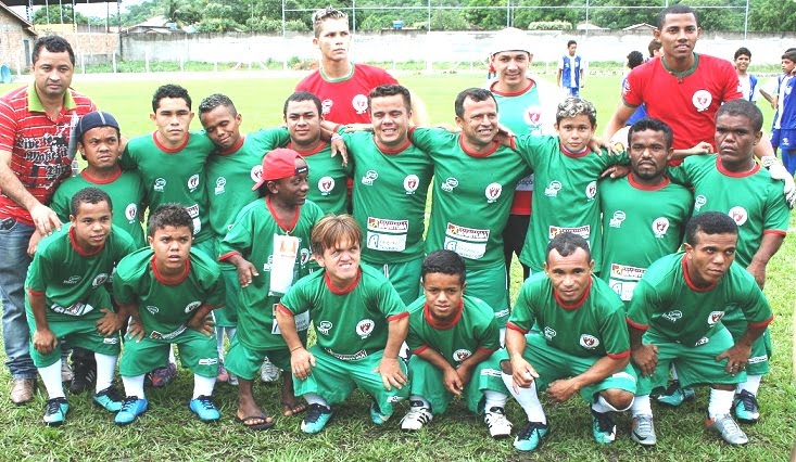 Une équipe de football composée de nains