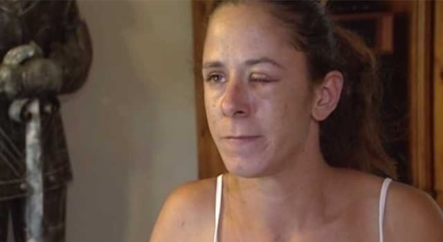 Son Ami Confond Des Gouttes Pour Les Yeux Avec De La Glue